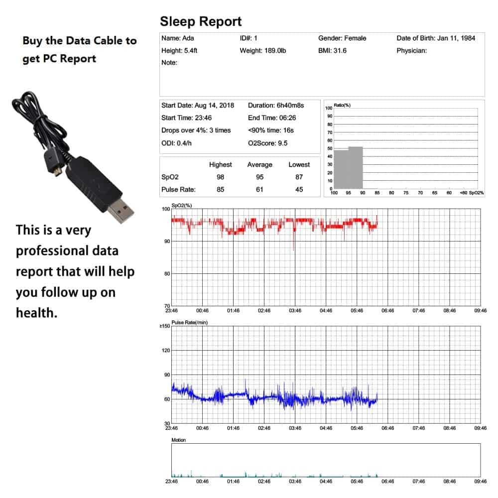 ENVN Pulse Oximeter Watch Bluetooth Smart Wrist Portable OLED Sleep apnea Monitor Insomnia Heart Beat Finger Pulsioximetro